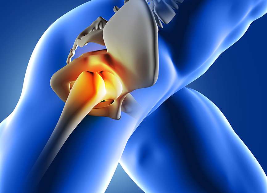 Hip, Buttock and Thigh Pain